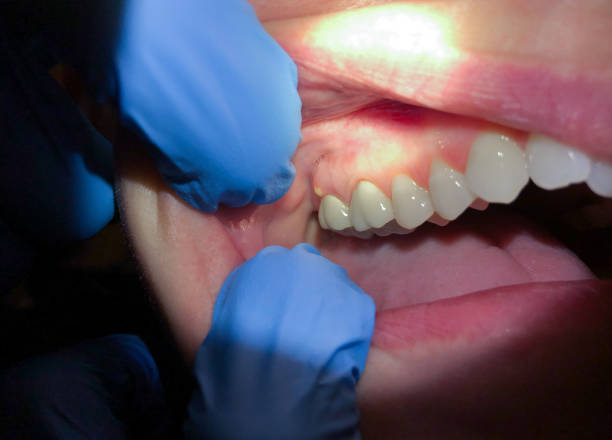 Best After-Hours Emergency Dentist in Wheaton, MD